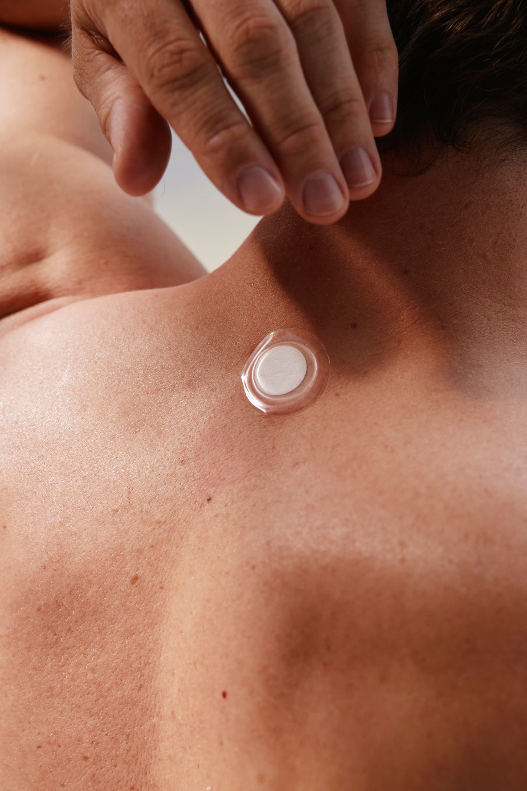 Patch applied on skin