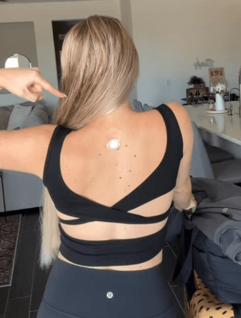 Patch placement on back